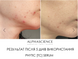 Оновлююча сироватка з фітиновою кислотою ALPHASCIENCE Phytic [TC] Serum 8ml ALPHASCIENCE Phytic [TC] Serum 8ml 425028out фото 3